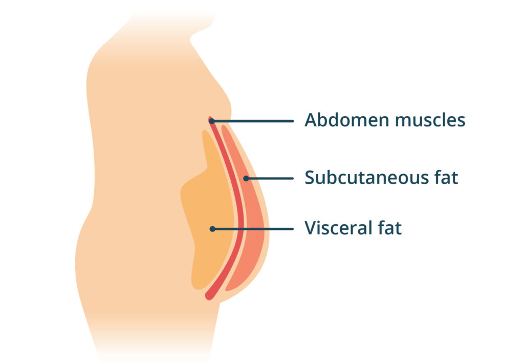 How to Lose Belly Fat